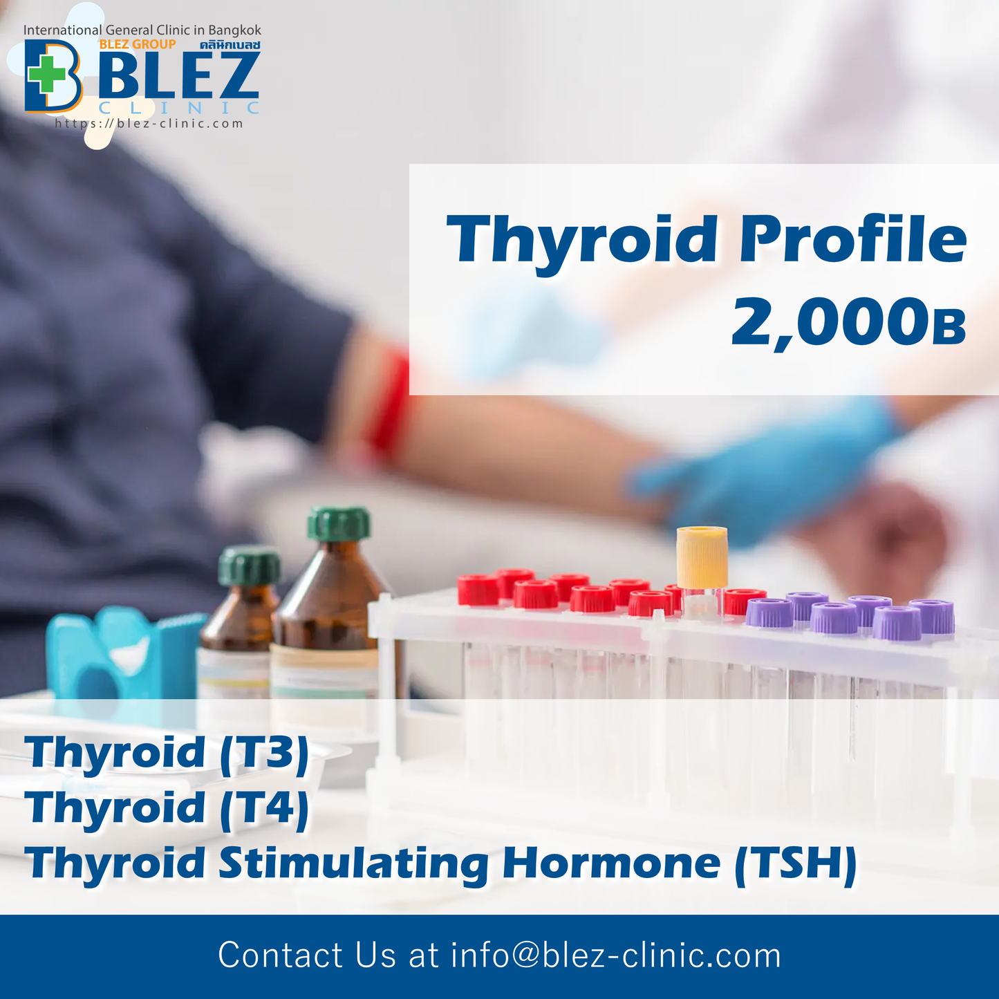 Thyroid hormone test